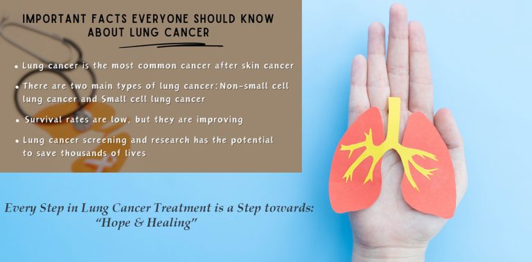 “Revolutionizing Non-Small Cell Lung Cancer Treatment: A Guide to Innovative Therapies and Care Options”