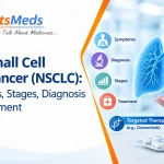 Non-Small Cell Lung Cancer (NSCLC) Symptoms, Stages, Diagnosis and Treatment